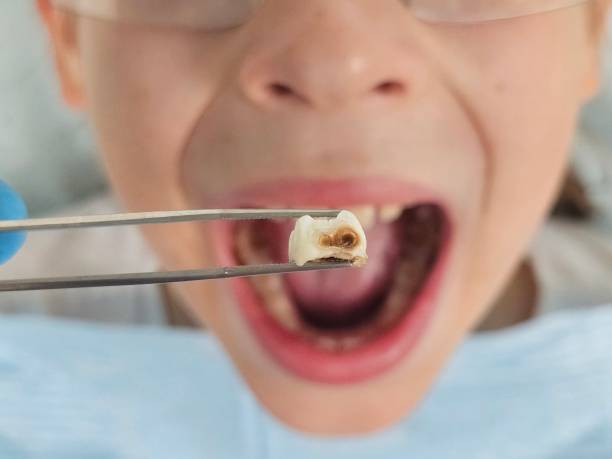 Best Pediatric Emergency Dentist in Russellton, PA